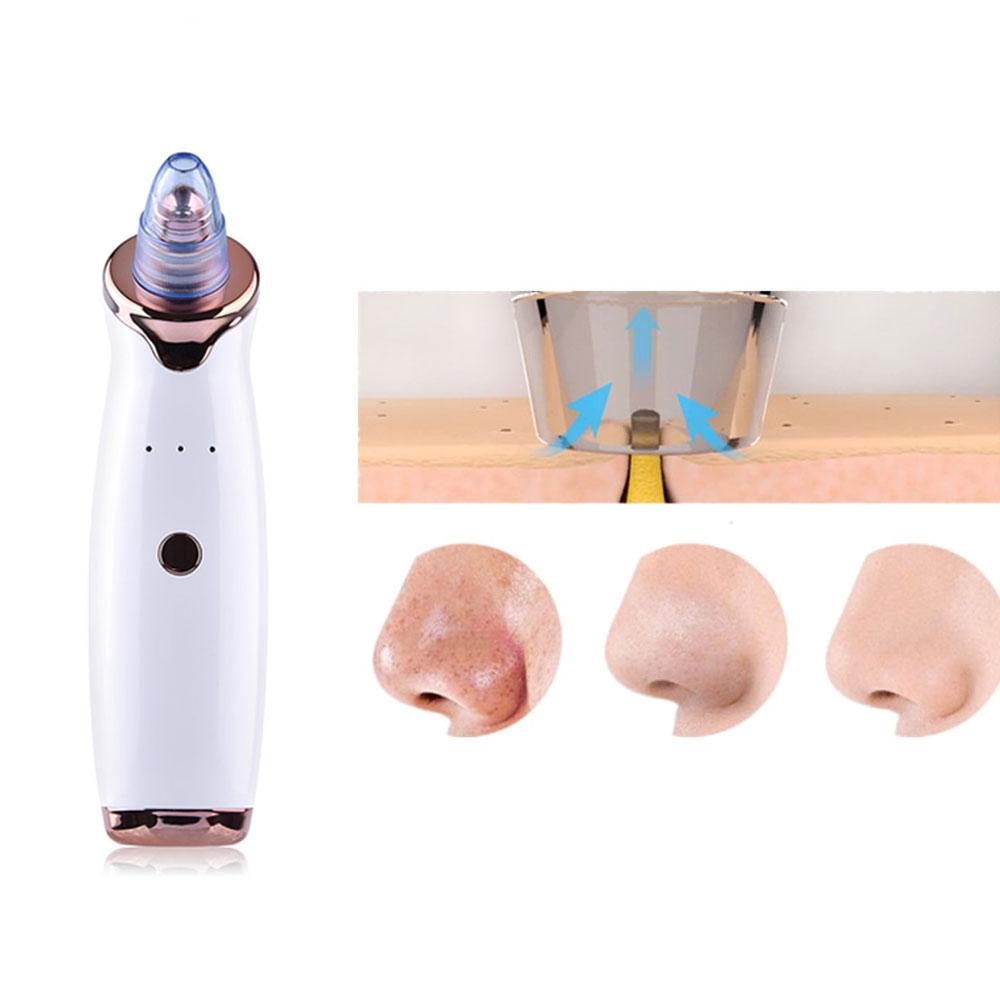 Blackhead And Blemish Remover Kit