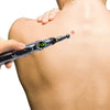 acupuncture pen pressure points